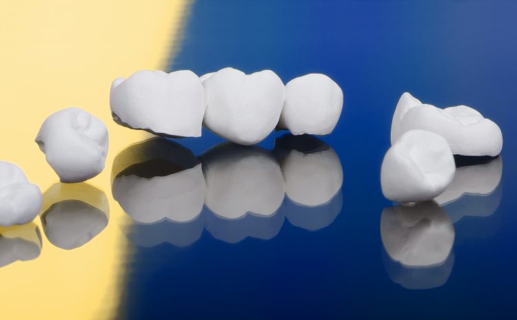  Yeni Nesil Diş Protezi