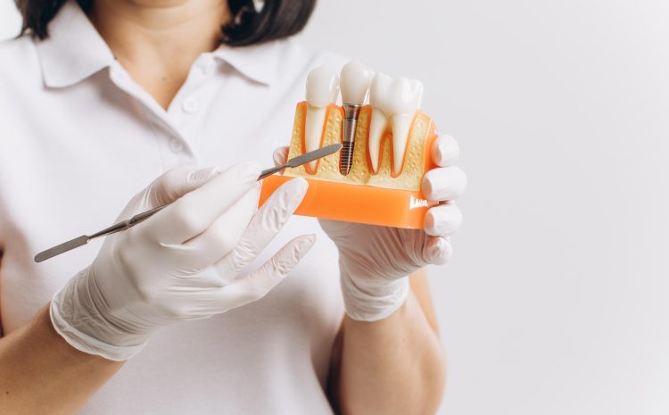  Understanding Dental Implants