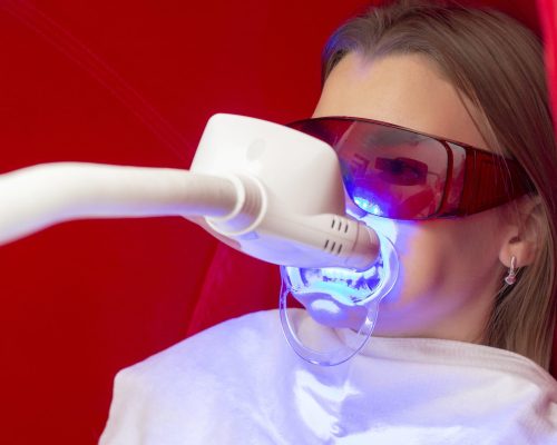 teeth whitening girl sits with aparts on teeth for teeth whitening in protective glasses